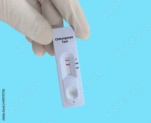 Scientists or Lab Technologists hold a device of chikungunya IgG, IgM rapid screening test, showing IgM positive results. photo