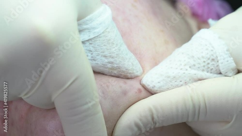 facial cleansing, black spot removal, cosmetology, acne removal, procedure with a cosmetologist