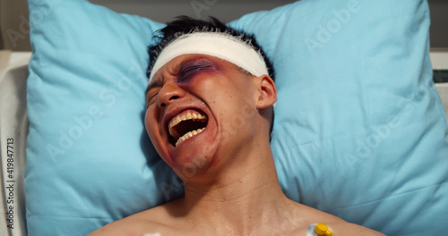 Canvas Print Injured young male patient with bruises on his face screaming in agony