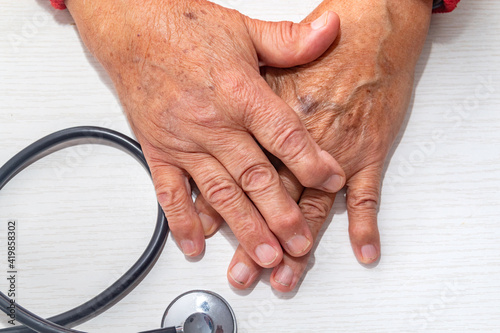 Hand of elderly man with osteoarthritis at doctor's office on white table