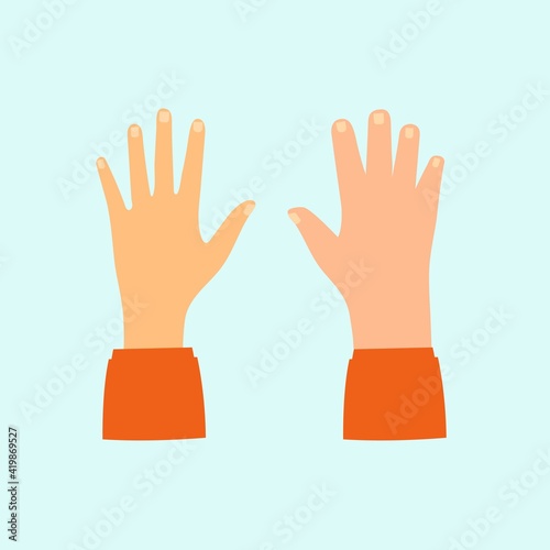 Edema.Swollen hands. Vector illustration