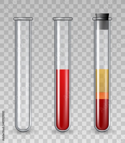Test tubes with blood. Realistic glass medical tube empty, filled with red cells, platelet rich plasma. PRP dermatology therapy vector set