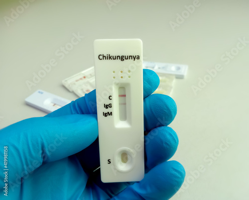 Close view of technician or technologist hand hold a device of chikungunya IgG, IgM rapid screening test, showing positive IgG result photo