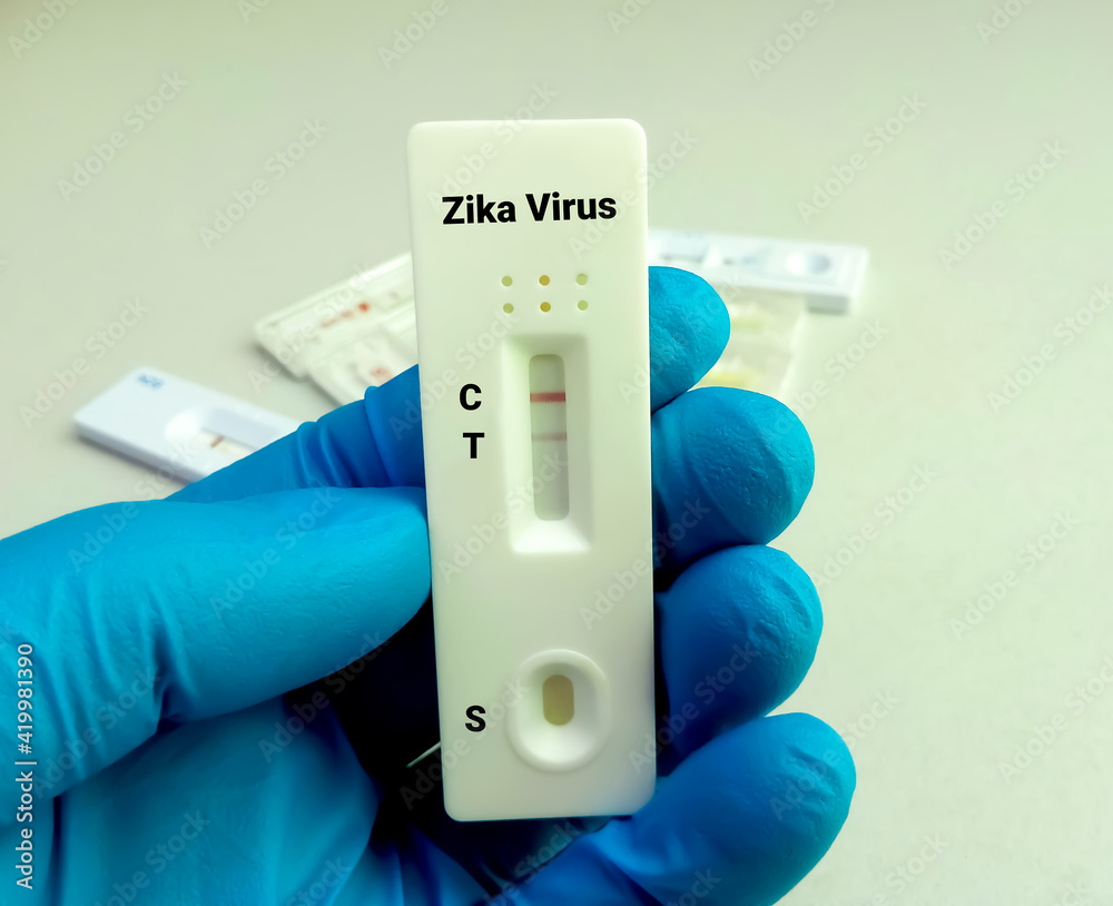 Close view of technician hand hold a device of Zika Virus rapid screening test, showing positive result Close view of technician hand hold a device of Zika Virus rapid screening test, showing positive result