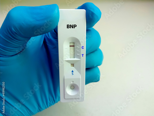 Scientist hold a test device or cassette for BNP test. Rapid screening test, myocardial infraction photo