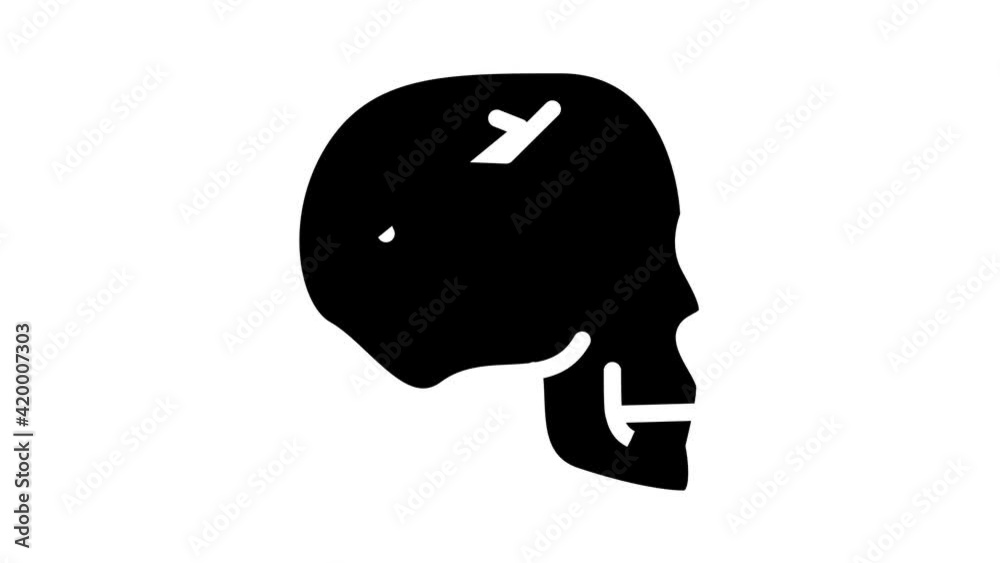 skull fracture glyph icon animation skull fracture glyph icon animation