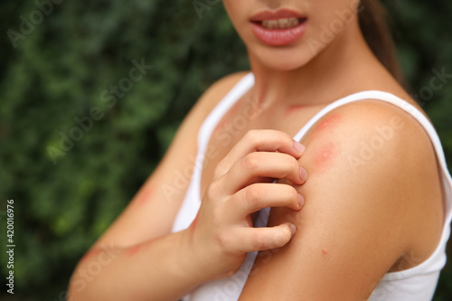Foto Woman scratching shoulder with insect bite outdoors, closeup