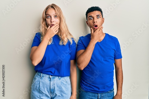 Young interracial couple wearing casual clothes looking fascinated with disbelief, surprise and amazed expression with hands on chin