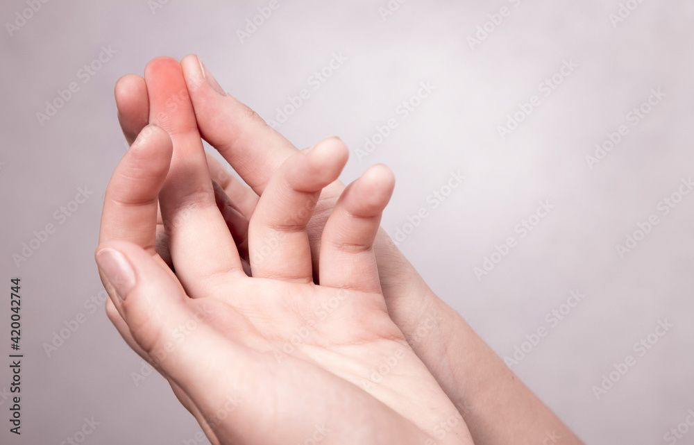 Fototapeta Finger pain. Medical and pharmaceutical concept. The woman is holding sore finger