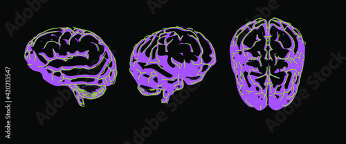 The human brain from the front and side view. MRI of CT scan.