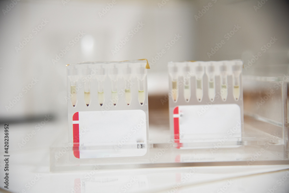 Test tube in laboratory testing.
