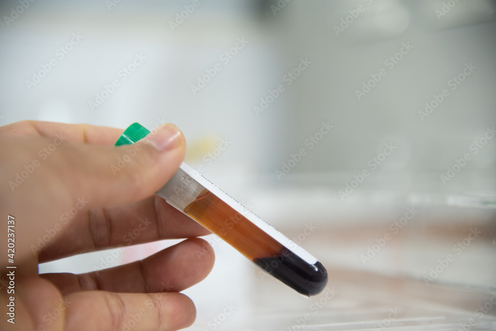 Test tube in laboratory testing. Test tube in laboratory testing.