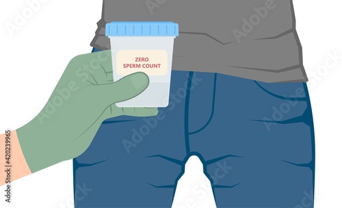 in vitro fertilization IVF semen test sample sperm count type Male biopsy fertility collect Low Poor Zero head anatomy midpiece tail birth control blocked defect abnormal ejaculate vas Non dry