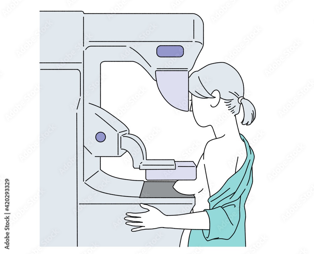 マンモグラフィーガイドライン