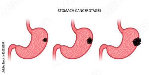 Stomach logo concept