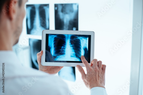 Doctor examining x-ray of chest and ribs on digital tablet.