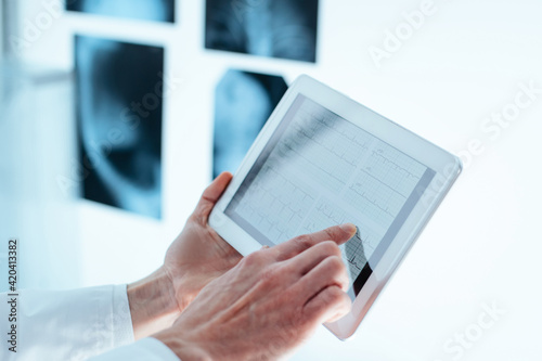 doctor with a digital tablet analyzing an X-ray.
