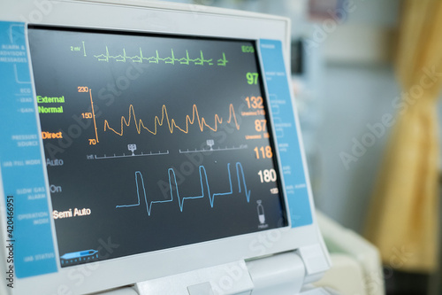 EKG monitor in intra aortic balloon pump machine. Medical equipment