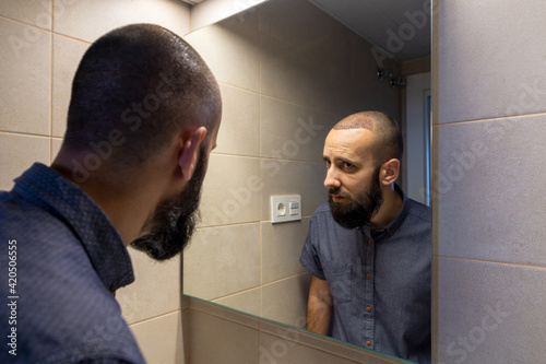 Man looking in front of mirror after the hair transplant operation
