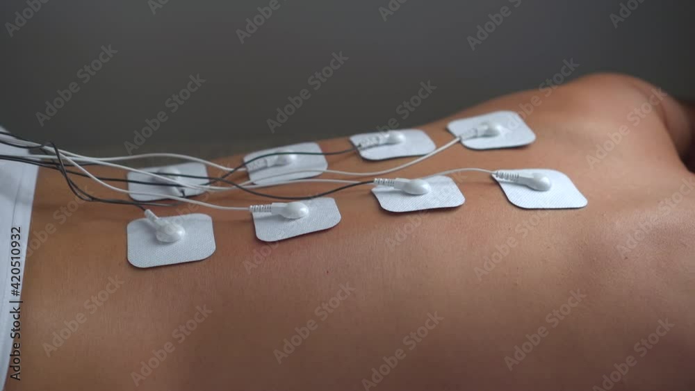 Myostimulation and physical therapy TENS of the back, electrical