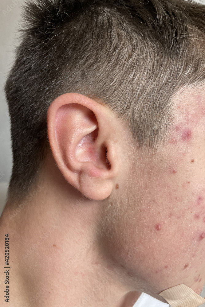 Obraz premium orecchio adolescente capelli 