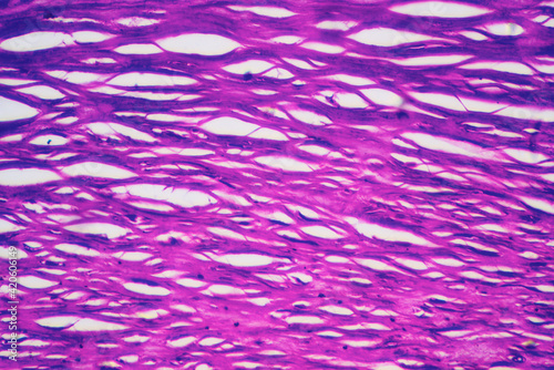 Wallpaper Mural micrograph of human coronary artery atherosclerosis cells Torontodigital.ca