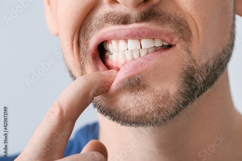 Man suffering from tooth ache, closeup photo