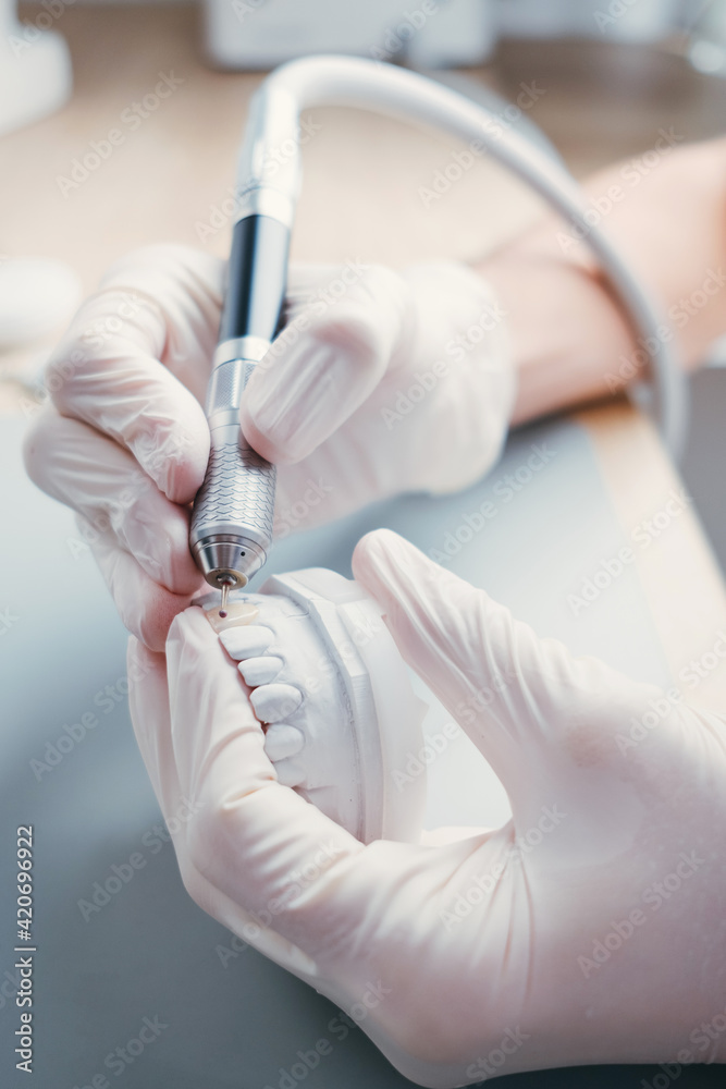 Dental Technician Making New Dental Prosthetics in Laboratory. Dental Technician Making New Dental Prosthetics in Laboratory.