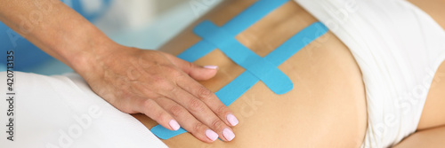 Canvas-taulu Kinesio taping of back is effective method of treating scoliosis and pain in clinic with elastic bands