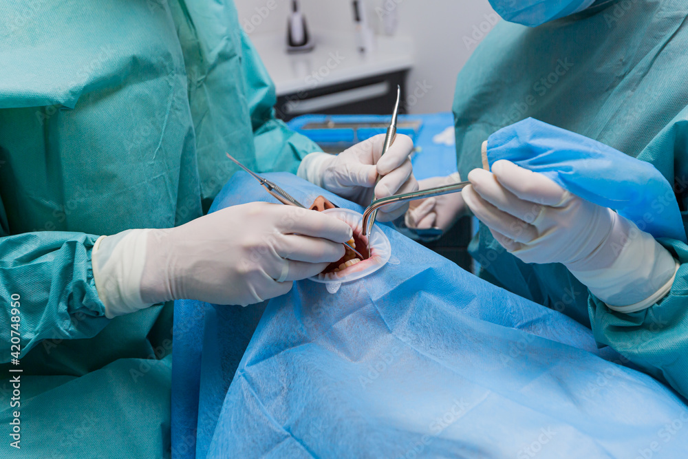 close up a team of dental surgeons performs surgery on a tooth. in a modern dental clinic. Top View. dentists examine the patient teeth before surgery. work of physicians in the operating room
close up a team of dental surgeons performs surgery on a tooth. in a modern dental clinic. Top View. dentists examine the patient teeth before surgery. work of physicians in the operating room