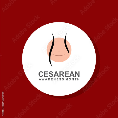 Cesarean awareness month
