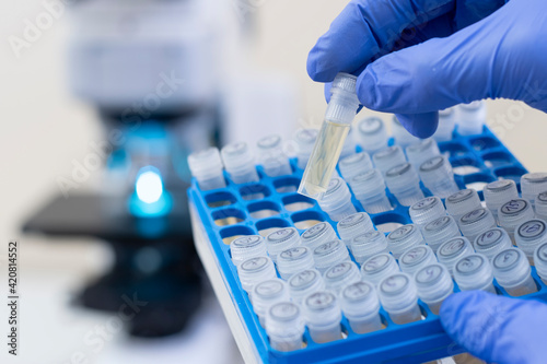 Close-up, a scientist takes out one small test tube of yellow liquid from a tripod against the background of a working microscope. A sample of a cure for diseases.