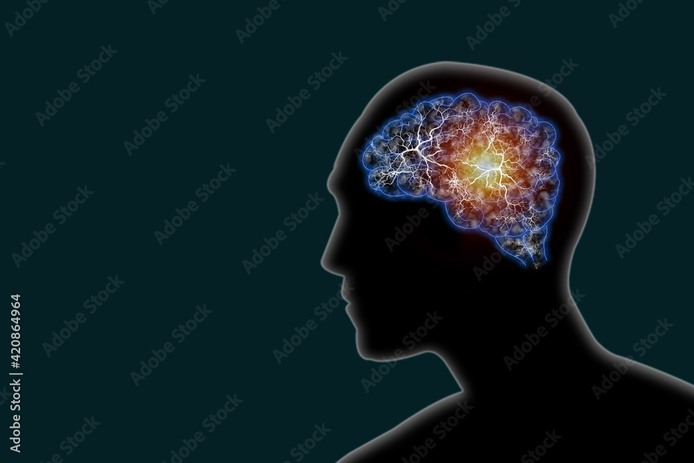 Illustration human brain and nerve or blood vessel concept in head on dark green background,