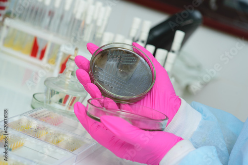 A researcher fills a Petri dish with a layer of nutrient medium and cultivates colonies of microorganisms. Bacteriological laboratory, bacterial analysis, close-up