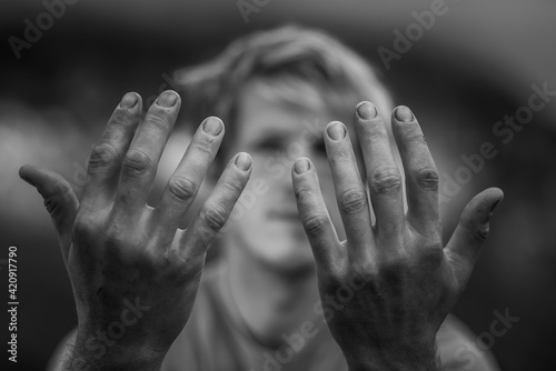 Man showing dirt covered nails and wounded fingers photo
