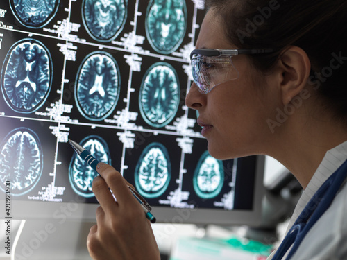 Neurology Diagnosis, Human brain scan on a screen being analysed by a female doctor in a neurology clinic. photo
