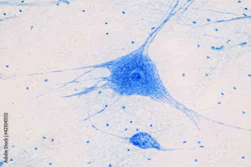 Education Spinal cord, Nerve, Cerebellum, Cortex and Motor Neuron Human under the microscope in Lab.
 photo