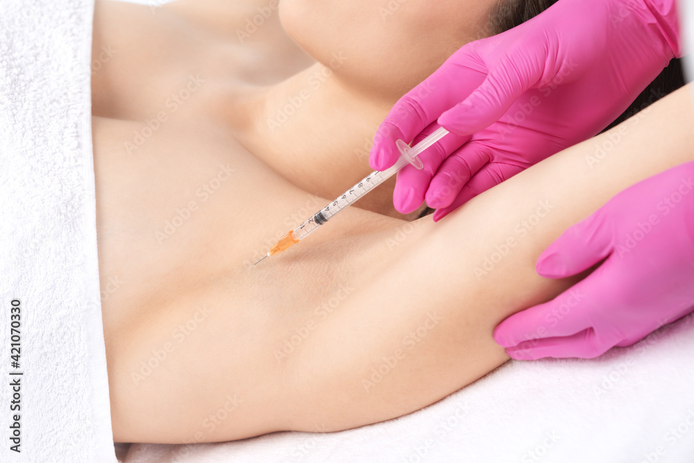 The doctor makes injections of botulinum toxin in the underarm area against hyperhidrosis. Women's cosmetology concept. The doctor makes injections of botulinum toxin in the underarm area against hyperhidrosis. Women's cosmetology concept.