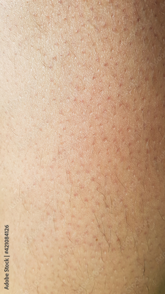 Haut Nahaufnahme Makro Haare Poren Rötung dermatologisch derma skin macro Reizung Pflege Punkte Härchen Zellen Papier Struktur