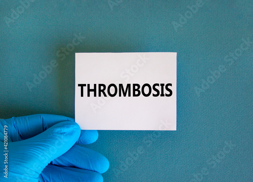 Medical and thrombosis symbol. Doctor hand. White card with the word 'thrombosis'. Beautiful blue background. Doctor hand in blue glove. Medical and and thrombosis concept. Copy space.