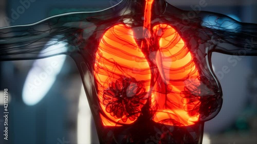 Human Lungs Radiology Exam in Laboratory photo