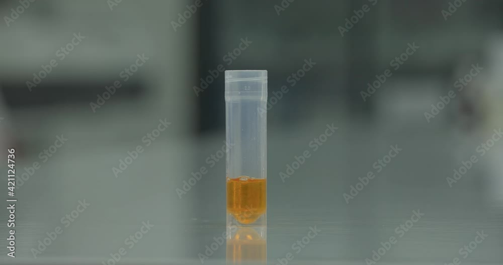 Color change reaction in test tube. Lab assistant mixing liquid using pipette. Red sample became yellow. Healthcare concept. Blurred background. Color change reaction in test tube. Lab assistant mixing liquid using pipette. Red sample became yellow. Healthcare concept. Blurred background.