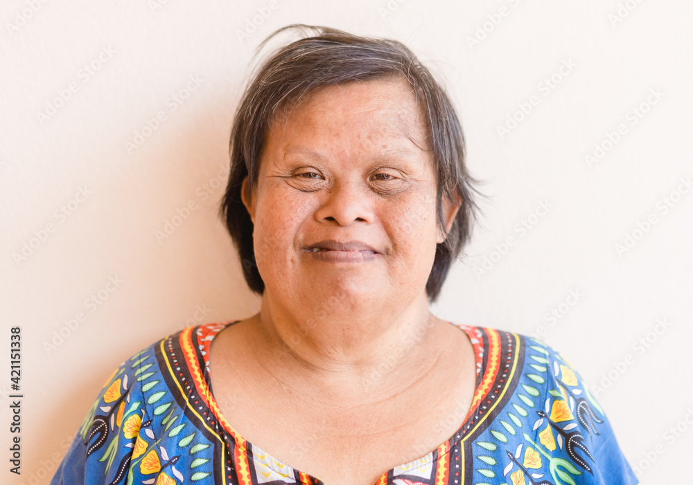 smiling asian down syndrome woman.Adult down syndrome.mentally disabled woman.Therapy mental