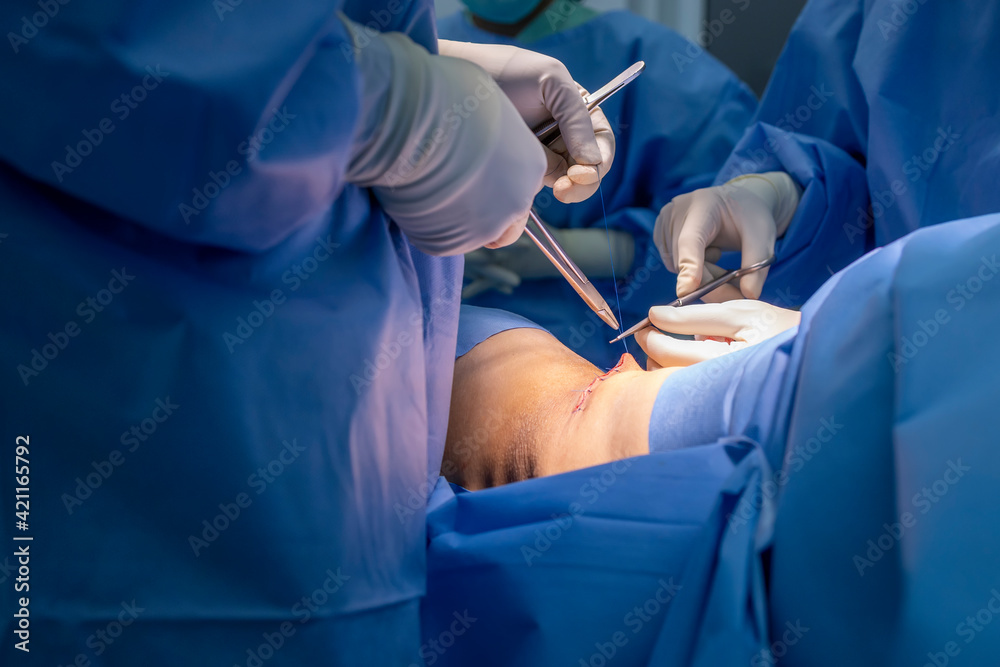 Surgery Look In Close up photo of Surgeon in blue surgical gown suit working inside ...