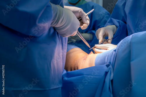 Close up photo of Surgeon in blue surgical gown suit working inside operating room.Selective focus at needle holder to suture wound in private hospital with blur background.Doctor wearing glove.