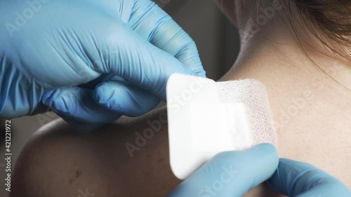 Doctor sticks a band-aid patch on the wound on the patient's back. A stitched wound on a woman's back. Doctor's hands close-up.