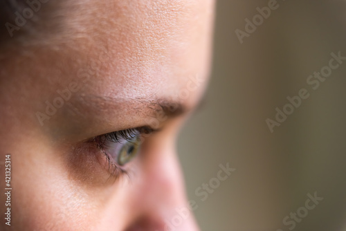 Macro closeup of young woman face portrait in profile side with Grave's disease hyperthyroidism symptoms of ophthalmopathy bulging eyes proptosis edema photo