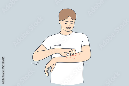 Skin allergy, Dermatitis, eczema concept. Annoyed young man in white t-shirt scratching itch on his arm feeling unhappy and uncomfortable vector illustration 