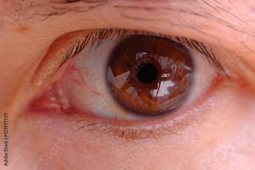 close up of a man eye and healthcare concept