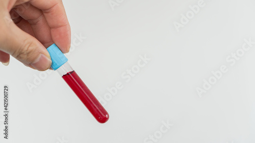 Laboratory doctor assistant is collecting experimental veins in laboratory isolated on white background.